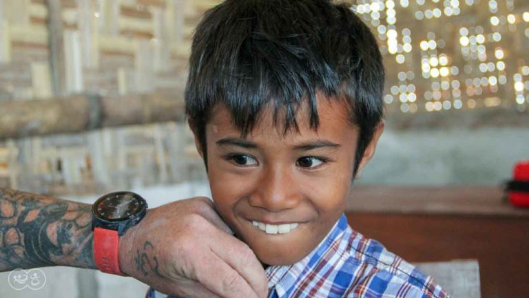 Assaria is a 9-year-old kid who burned 20% of his body at the beginning of 2021