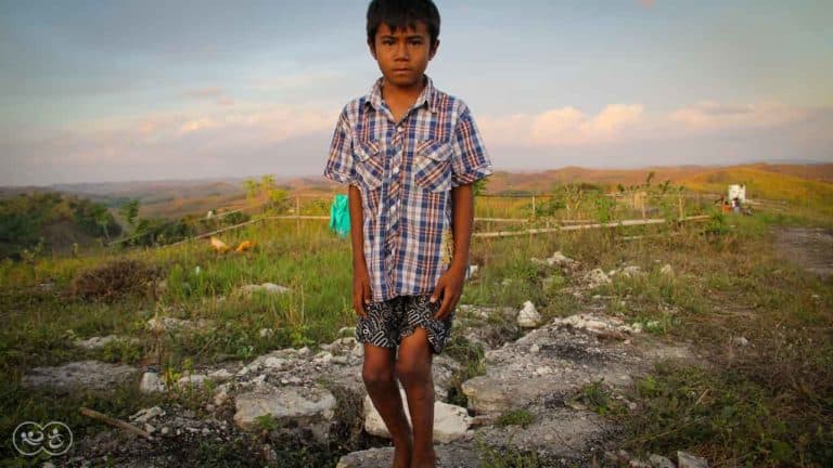 Assaria is a 9-year-old kid who burned 20% of his body at the beginning of 2021
