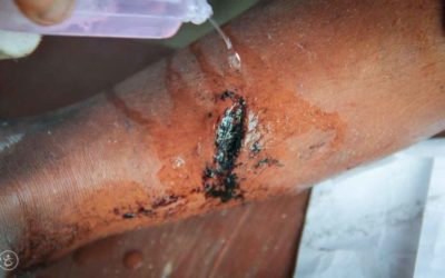 On-site Primary Medical Care Program Assessment