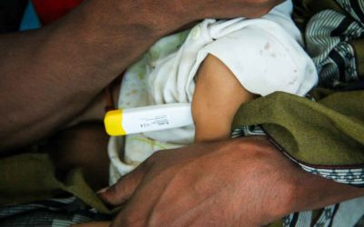 How Primary Medical Care Rescued a 10-Year-Old in Remote East Sumba