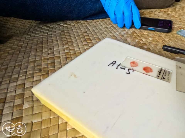 A Drop of Hope: Blood Testing for Malaria in East Sumba by Fair Future.