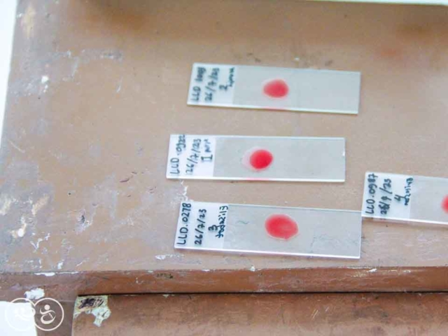 A Drop of Hope: Blood Testing for Malaria in East Sumba by Fair Future.