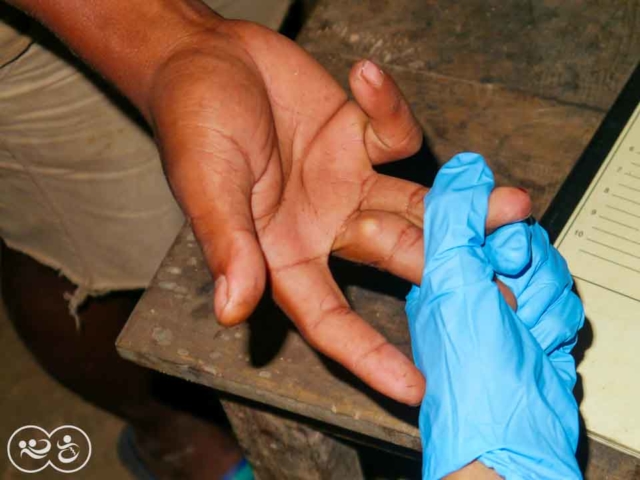 Blood Testing for Malaria in East Sumba by Fair Future