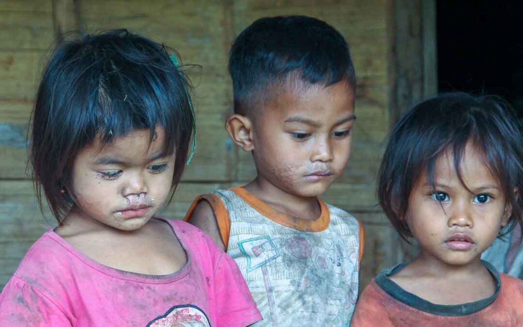 Polio Resurgence in Remote Indonesia: Urgent Action Needed