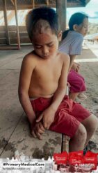 Health agents providing medical care in ultra-rural East Sumba for the Primary Medical Care Program.