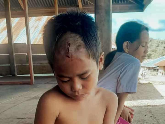 A health agent from Kawan Sehat is providing medical care to a patient in a remote village.