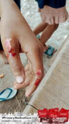A health agent from Kawan Sehat is providing medical care to a patient in a remote village.