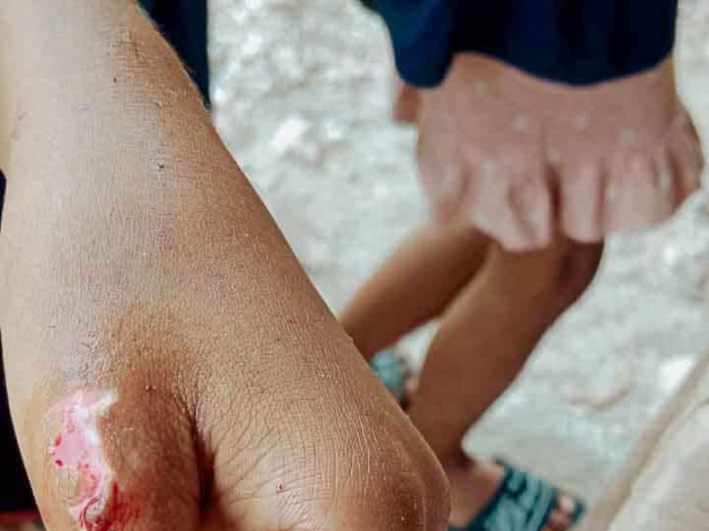 A health agent from Kawan Sehat is providing medical care to a patient in a remote village.