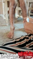 A health agent from Kawan Sehat is providing medical care to a patient in a remote village.