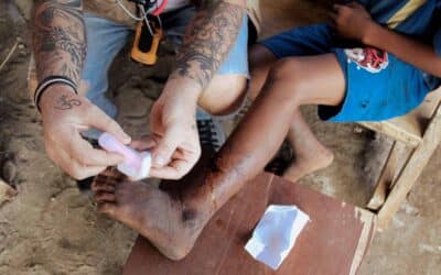 Preventing and Treating Dog Bites in Remote Areas