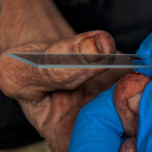 Image showing why Fair Future acts for water, dignity, and healthcare in rural Indonesia