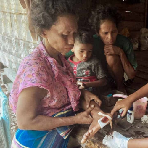Image showing why Fair Future acts for water, dignity, and healthcare in rural Indonesia