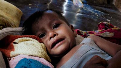 Malnourished child in pain rural Indonesia • The Fair Future Foundation Malnourished child in pain lying at home without medical care in rural Indonesia