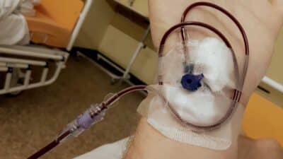 Close-up of a patient's hand receiving a blood transfusion through an IV line
