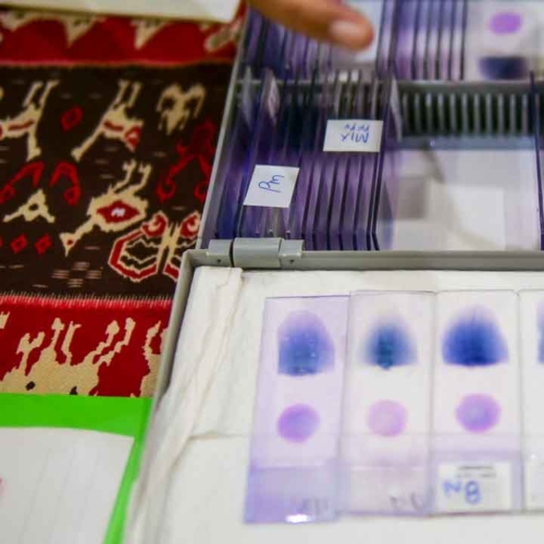 Malaria diagnostics training for all East Sumba analysts