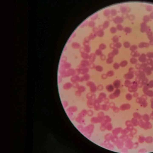 Malaria diagnostics training for all East Sumba analysts
