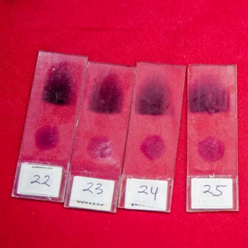 Malaria diagnostics training for all East Sumba analysts