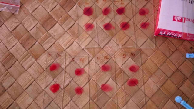 Malaria Education in Umalulu