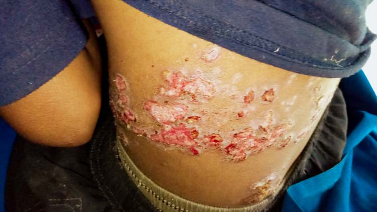 Farmers affected by drought and climate change struggling to grow crops.