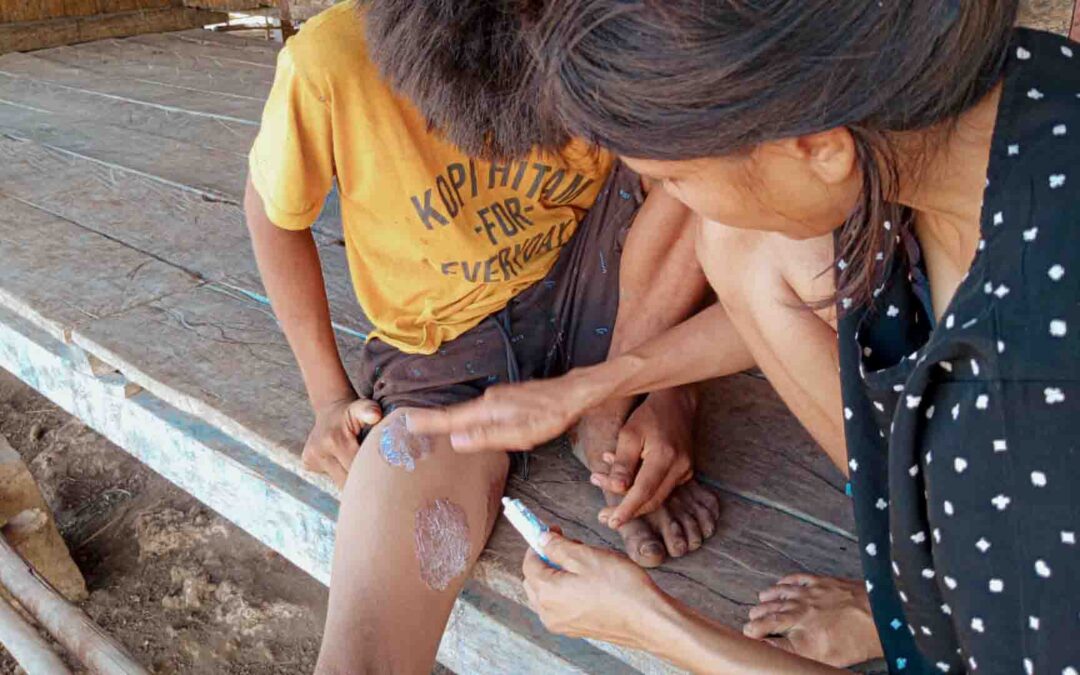 Skin infection prevention in rural Indonesia
