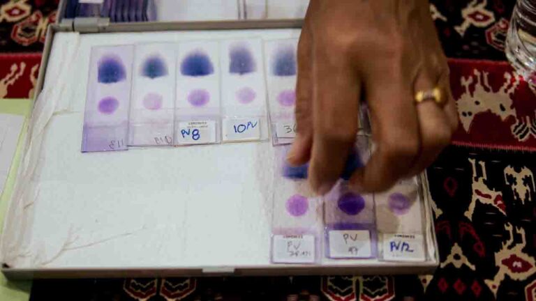 Malariamikroskopie-Schulungstag zwei Der zweite Tag der Mikroskopie-Schulung zum Malaria-Screening fand in abgelegenen Kliniken in Ost-Sumba statt und beinhaltete eine Schulung in der Bildverarbeitung.