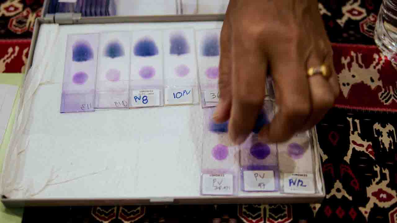 Malariamikroskopie-Schulungstag zwei Der zweite Tag der Mikroskopie-Schulung zum Malaria-Screening fand in abgelegenen Kliniken in Ost-Sumba statt und beinhaltete eine Schulung in der Bildverarbeitung.