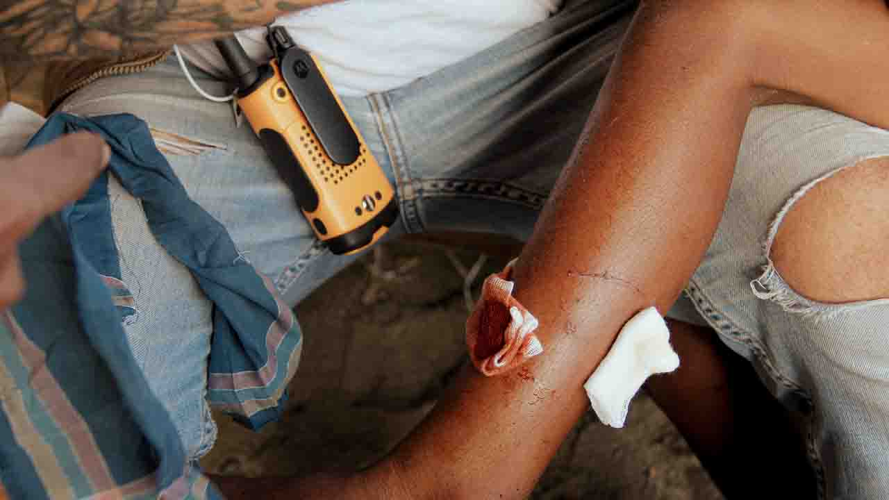 Early infection care to prevent sepsis Early wound and infection care to prevent sepsis in rural Indonesia