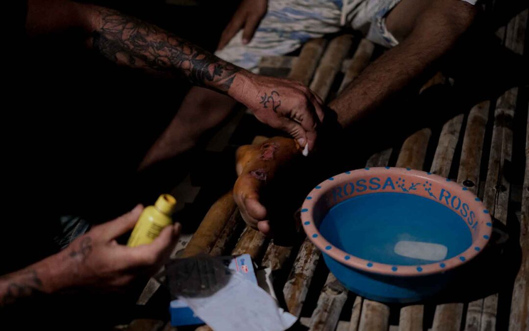 Sepsi nella zona rurale dell’Indonesia | Prevenire le morti silenziose
