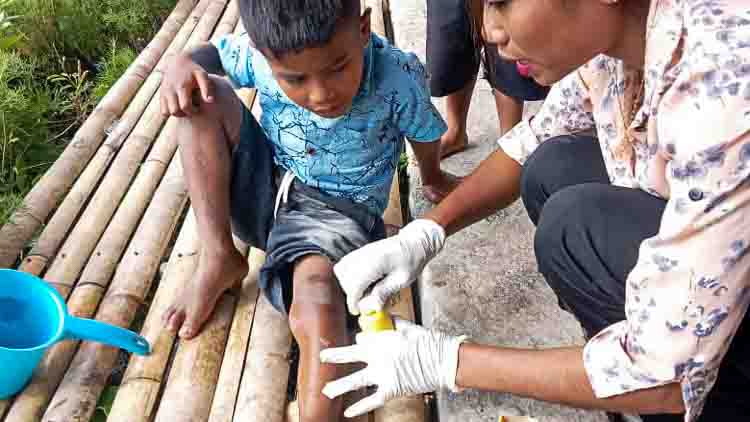 Ida, a health worker with the Fair Future Foundation's Kawan Sehat program, treats a child's wound during a home visit in a remote village. This type of early care helps prevent infections, complications, and potentially fatal sepsis.