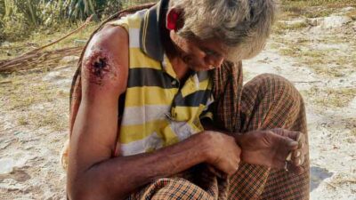 Man with a bleeding wound on his upper left arm sits on dusty ground outdoors, examining his arm.