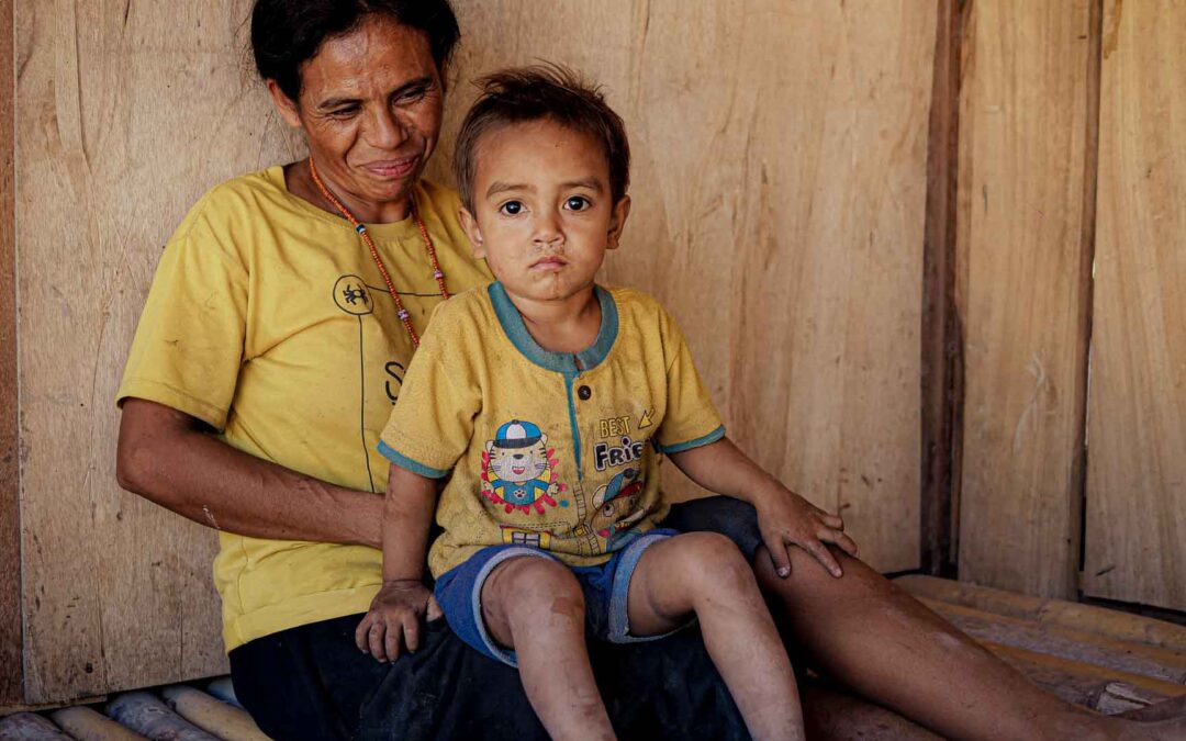 Rural Child Health in East Sumba | Before Emergency