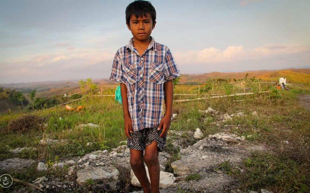 Assaria is a 9-year-old kid who burned 20% of his body at the beginning of 2021