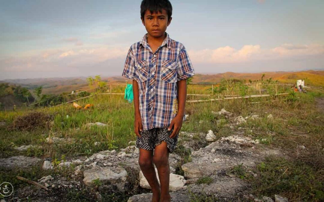 Assaria is a 9-year-old kid who burned 20% of his body at the beginning of 2021