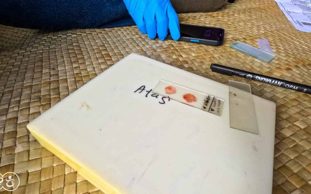 A Drop of Hope Blood Testing for Malaria in East Sumba by Fair Future