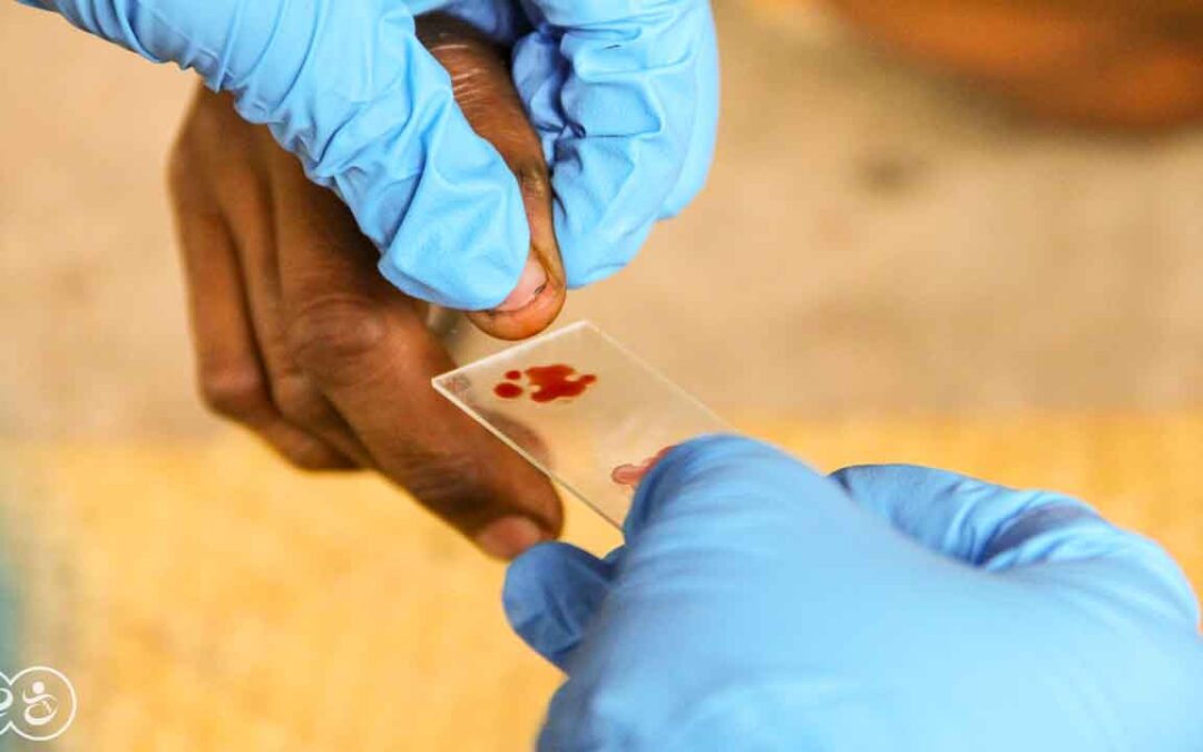 A Drop of Hope Blood Testing for Malaria in East Sumba by Fair Future