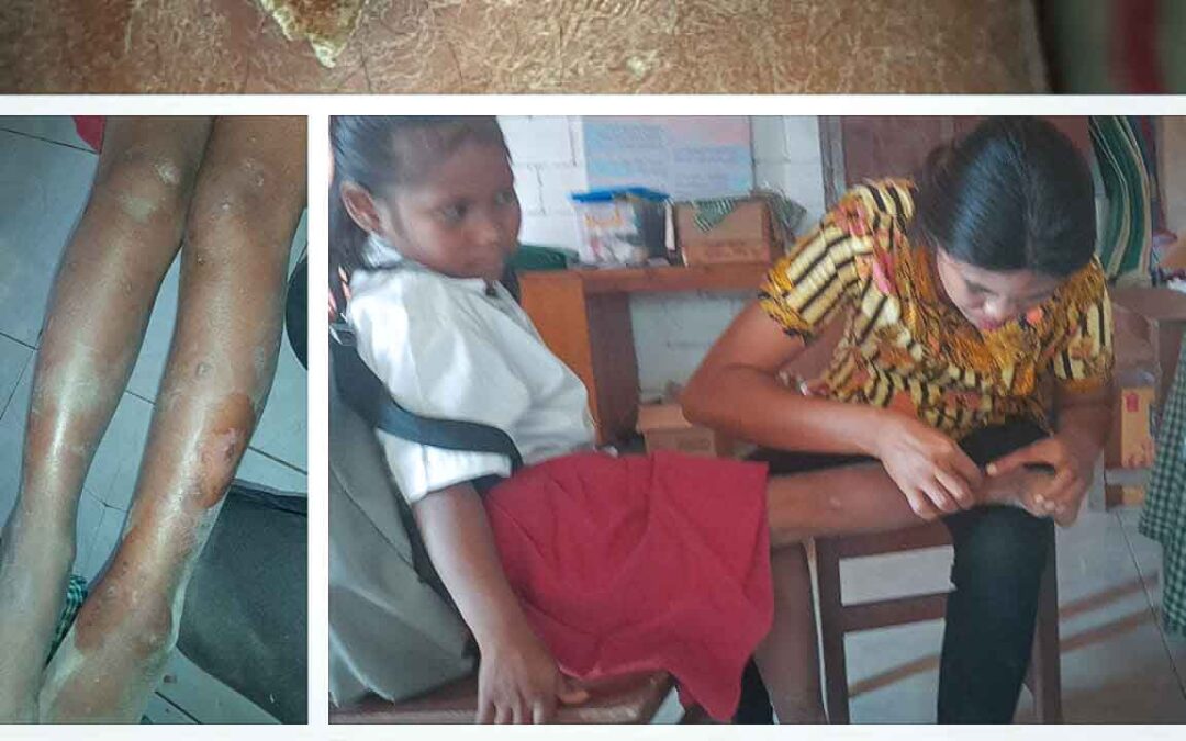 April May 2023 – Images taken by teachers providing medical care for the primary medical care programme