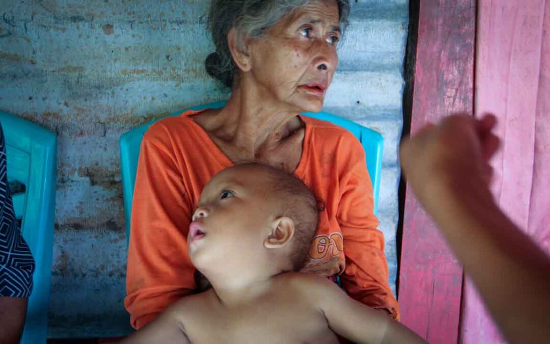 We assess the cases of patients cared for by health workers in the village of Kabanda Sumba Timur