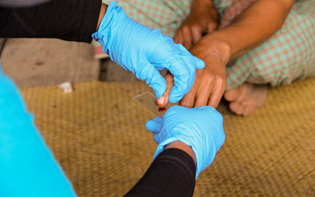 A Drop of Hope Blood Testing for Malaria in East Sumba by Fair