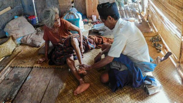 Elderly patient receiving pain treatment and wound care in rural Indonesia home setting